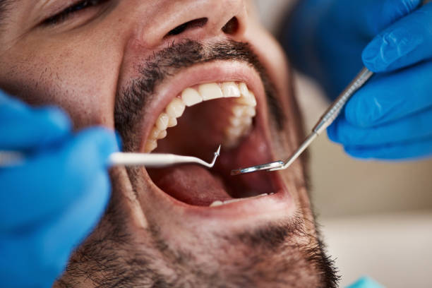 Best Dental Exams and Cleanings  in Jacksboro, TX