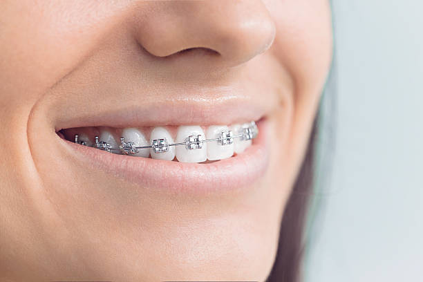 Best Traditional Braces  in Jacksboro, TX